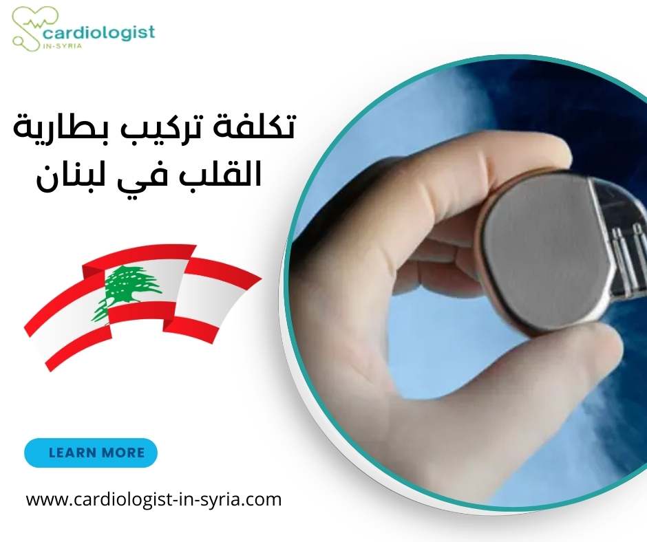 تكلفة تركيب بطارية القلب في لبنان