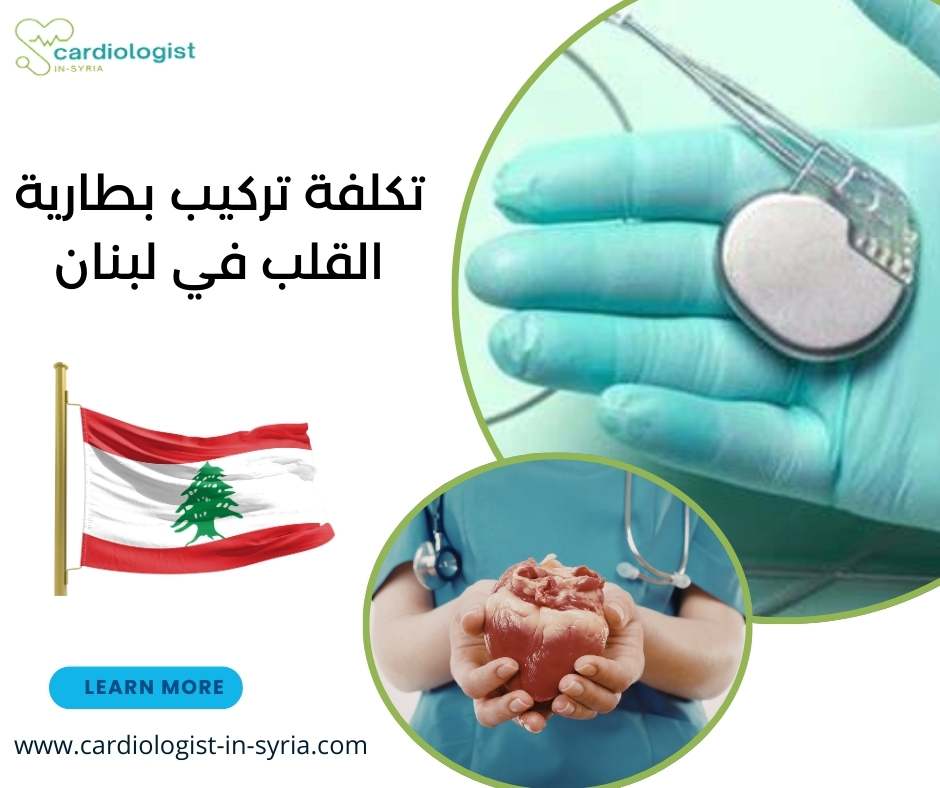 تكلفة تركيب بطارية القلب في لبنان