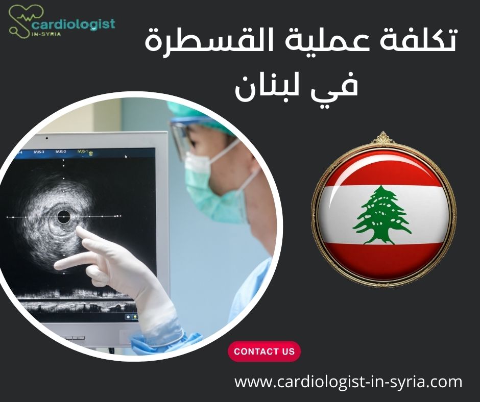 تكلفة عملية القسطرة في لبنان
